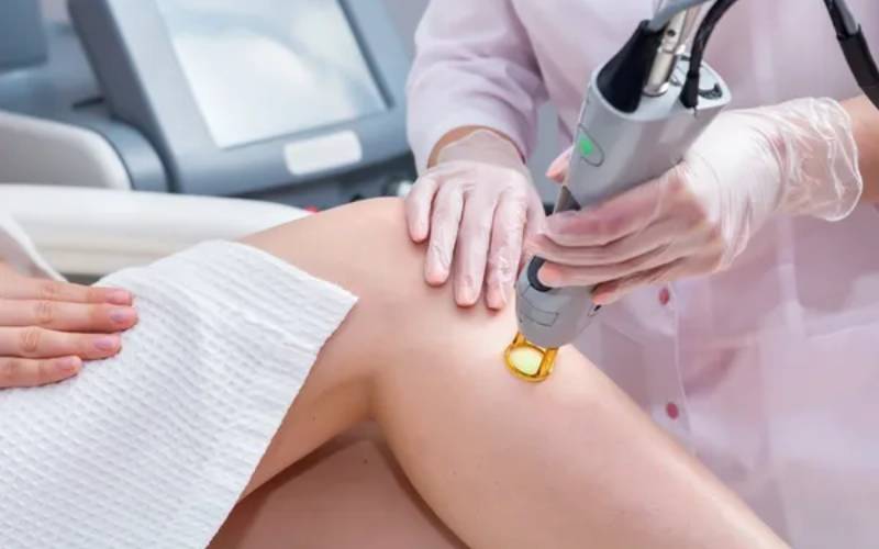 laser hair removal cleveland